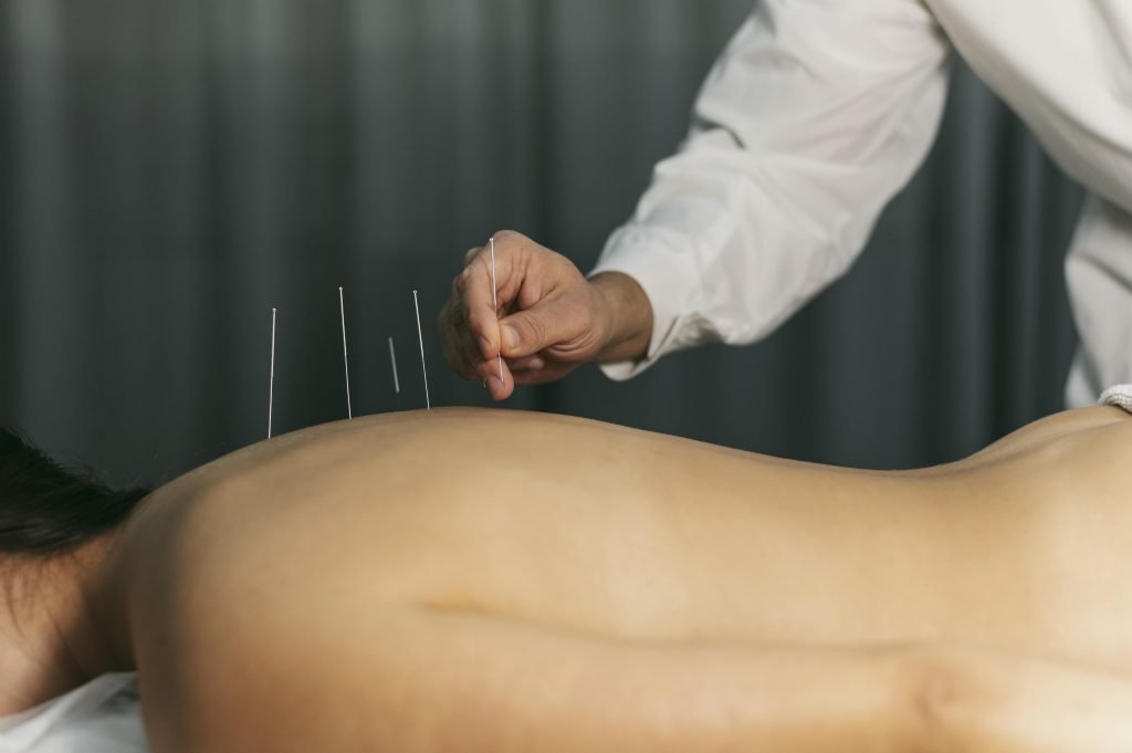 Acupuncturist in Zaanstad